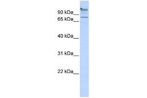WB Suggested Anti-ZNF509 Antibody Titration:  0. (ZBTB49 antibody  (Middle Region))