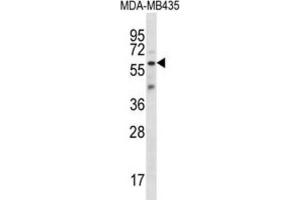 Western Blotting (WB) image for anti-Fascin 3 (FSCN3) antibody (ABIN2997133) (Fascin 3 antibody)