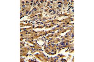 Immunohistochemistry (IHC) image for anti-ATP-Binding Cassette, Sub-Family G (WHITE), Member 1 (ABCG1) antibody (ABIN3002669) (ABCG1 antibody)