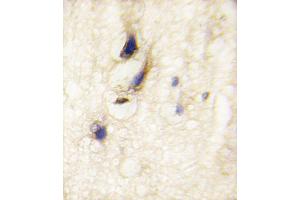 Formalin-fixed and paraffin-embedded human brain tissue reacted with DAAM1 Antibody , which was peroxidase-conjugated to the secondary antibody, followed by DAB staining. (DAAM1 antibody  (C-Term))