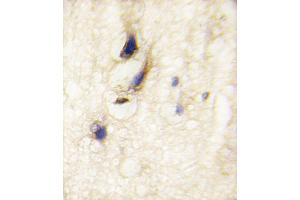 Formalin-fixed and paraffin-embedded human brain tissue reacted with DAAM1 Antibody , which was peroxidase-conjugated to the secondary antibody, followed by DAB staining.