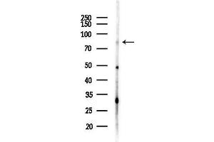 anti-PRP3 Pre-mRNA Processing Factor 3 Homolog (PRPF3) (N-Term) antibody