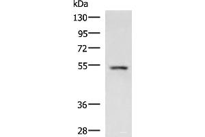Western blot analysis of Rat liver tissue lysate using ONECUT1 Polyclonal Antibody at dilution of 1:600 (ONECUT1 antibody)