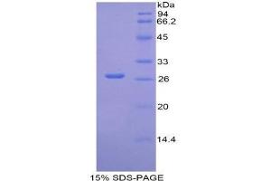 SDS-PAGE (SDS) image for Interleukin 2 Receptor, beta (IL2RB) (AA 27-240) protein (His tag) (ABIN1877289)