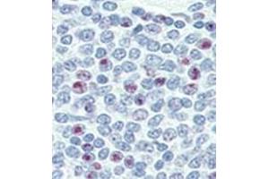 Image no. 2 for anti-Nanog Homeobox (NANOG) (AA 25-54), (N-Term) antibody (ABIN357014)