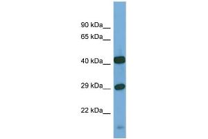 Host:  Rabbit  Target Name:  SGSH  Sample Type:  PANC1 Whole Cell lysates  Antibody Dilution:  1. (SGSH antibody  (C-Term))