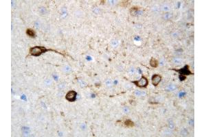 Anti-CAMKK2 antibody, IHC(P) IHC(P): Rat Brain Tissue (CAMKK2 antibody  (Middle Region))