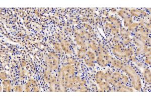 Immunohistochemistry (IHC) image for anti-Leptin Receptor (LEPR) (AA 22-203) antibody (ABIN7430876)