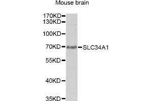 Western blot analysis of extracts of mouse brain, using SLC34A1 antibody. (Solute Carrier Family 34 (Type II Sodium/phosphate Contransporter), Member 1 (SLC34A1) antibody)