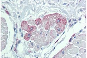 Heart, Human: Formalin-Fixed, Paraffin-Embedded (FFPE) (TRPM2 antibody  (AA 431-480))