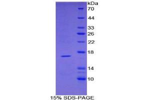 SDS-PAGE analysis of Mouse TNFRSF19L Protein. (TNFRSF19 Protein)