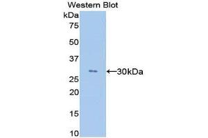 Western Blotting (WB) image for anti-Angiopoietin-Like 4 (ANGPTL4) (AA 182-394) antibody (ABIN1858006) (ANGPTL4 antibody  (AA 182-394))