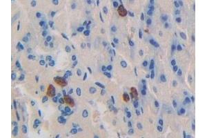 Detection of DNM1 in Mouse Stomach Tissue using Polyclonal Antibody to Dynamin 1 (DNM1) (Dynamin 1 antibody  (AA 572-745))
