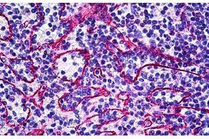 Human Spleen: Formalin-Fixed, Paraffin-Embedded (FFPE) (TIE1 antibody  (Internal Region))