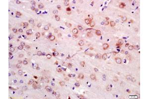 Immunohistochemistry (IHC) image for anti-Neural Precursor Cell Expressed, Developmentally Down-Regulated 4, E3 Ubiquitin Protein Ligase (NEDD4) (AA 801-900) antibody (ABIN872620)