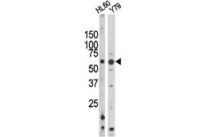 Western Blotting (WB) image for anti-RAD9 Homolog A (S. Pombe) (RAD9A) (pSer328) antibody (ABIN3001777) (RAD9A antibody  (pSer328))