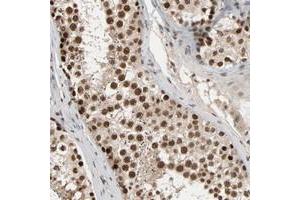 Immunohistochemical staining of human testis with SMARCD1 polyclonal antibody  shows strong nuclear positivity in cells in seminiferus ducts at 1:50-1:200 dilution. (SMARCD1 antibody)