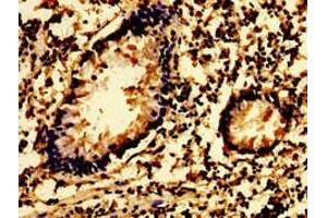 Immunohistochemistry of paraffin-embedded human appendix tissue using ABIN7174068 at dilution of 1:100 (SYK antibody  (AA 260-361))