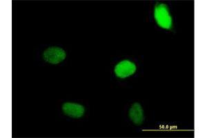 Immunofluorescence of purified MaxPab antibody to ZNF35 on HeLa cell. (ZNF35 antibody  (AA 1-519))