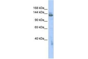Image no. 1 for anti-Zinc Finger, MYND-Type Containing 8 (ZMYND8) (AA 1115-1164) antibody (ABIN6742534) (ZMYND8 antibody  (AA 1115-1164))