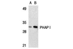 Western Blotting (WB) image for anti-PHAP I (C-Term) antibody (ABIN1030578)