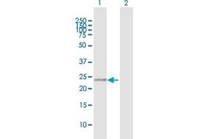 Western Blot analysis of RANBP1 expression in transfected 293T cell line by RANBP1 MaxPab polyclonal antibody.