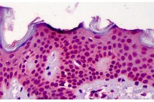 Human Skin: Formalin-Fixed, Paraffin-Embedded (FFPE) (NUP107 antibody  (Internal Region))