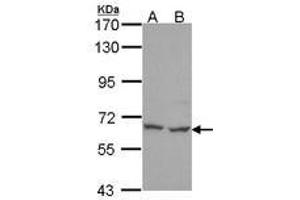 Image no. 1 for anti-Polynucleotide Kinase 3'-Phosphatase (PNKP) (AA 1-243) antibody (ABIN467497) (PNKP antibody  (AA 1-243))
