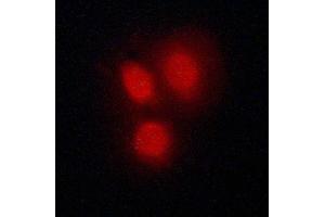 ABIN6269137 staining A549 cells by ICC/IF. (Vitamin D Receptor antibody  (Internal Region))