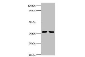 Western blot All lanes: Methylosome protein 50 antibody at 6 μg/mL Lane 1: Hela whole cell lysate Lane 2: HepG2 whole cell lysate Secondary Goat polyclonal to rabbit IgG at 1/10000 dilution Predicted band size: 37, 30 kDa Observed band size: 37 kDa (WDR77 antibody  (AA 1-260))