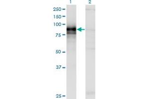 Western Blot analysis of HHIP expression in transfected 293T cell line by HHIP monoclonal antibody (M01), clone 5D11. (HHIP antibody  (AA 21-120))