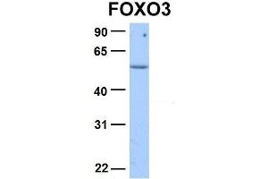Host:  Rabbit  Target Name:  FOXO3  Sample Type:  Human Adult Placenta  Antibody Dilution:  1. (FOXO3 antibody  (N-Term))
