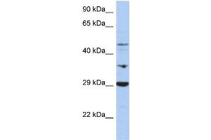 WB Suggested Anti-PDK3 Antibody Titration:  0. (PDK3 antibody  (Middle Region))