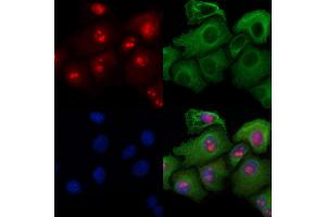 ABIN6258822 and ABIN6274418 staining Hela cells by IF/ICC.