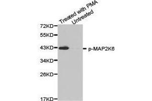 Western Blotting (WB) image for anti-Mitogen-Activated Protein Kinase Kinase 6 (MAP2K6) (pSer207) antibody (ABIN1870361) (MAP2K6 antibody  (pSer207))
