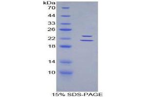 SDS-PAGE (SDS) image for Endothelin 1 (EDN1) (AA 33-202) protein (His tag) (ABIN2120988)