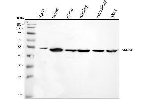 Western blot analysis of ALDH2 using anti-ALDH2 antibody (ABIN3043782). (ALDH2 antibody  (N-Term))