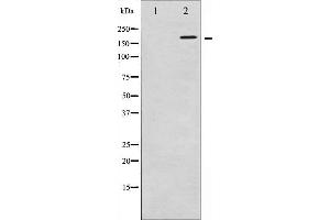 Western blot analysis of FANCD2 expression in CalyculinA treated HT29 whole cell lysates,The lane on the left is treated with the antigen-specific peptide. (FANCD2 antibody  (N-Term))