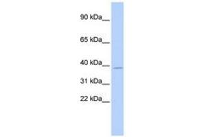 Image no. 1 for anti-Ts Translation Elongation Factor, Mitochondrial (TSFM) (AA 144-193) antibody (ABIN6740259) (TSFM antibody  (AA 144-193))