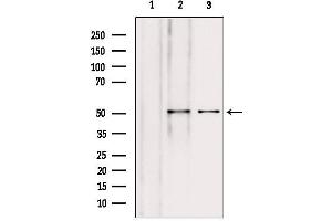 Western blot analysis of extracts from various samples, using NAPRT1 antibody. (NAPRT1 antibody  (Internal Region))