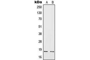 Western blot analysis of IL-4 expression in HeLa (A), Raji (B) whole cell lysates. (IL-4 antibody  (Center))