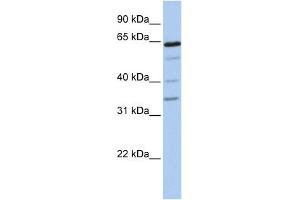 WB Suggested Anti-GALNTL1 Antibody Titration:  0. (GALNTL1 antibody  (N-Term))