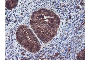 Image no. 1 for anti-Kelch-Like ECH-Associated Protein 1 (KEAP1) antibody (ABIN1499016) (KEAP1 antibody)