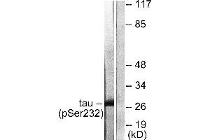 Immunohistochemistry analysis of paraffin-embedded human pancreas tissue using 14-3-3 θ/τ (Phospho-Ser232) antibody. (14-3-3 theta antibody  (pSer232))
