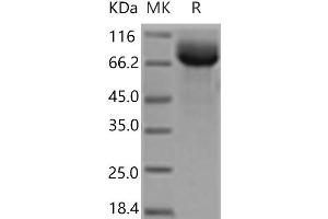 HEPACAM2 Protein (Fc Tag)