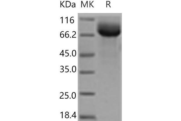 HEPACAM2 Protein (Fc Tag)