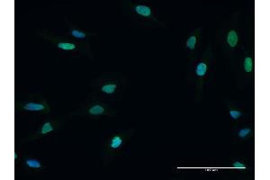 Immunofluorescence of purified MaxPab antibody to MCM5 on HeLa cell. (MCM5 antibody  (AA 1-734))