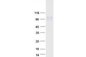 Validation with Western Blot