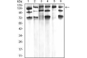 Western Blotting (WB) image for anti-phospholipase C, gamma 1 (PLCG1) (AA 1192-1291) antibody (ABIN5933333) (Phospholipase C gamma 1 antibody  (AA 1192-1291))