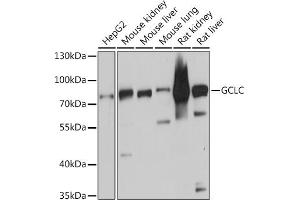 Western blot analysis of extracts of various cell lines, using GCLC antibody (ABIN6130444, ABIN6141016, ABIN6141017 and ABIN6214615) at 1:3000 dilution. (GCLC antibody  (AA 1-252))